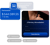 Estrategias de email marketing para recuperar carritos abandonados